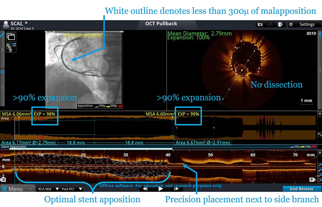 OPTIS™ Imaging Systems